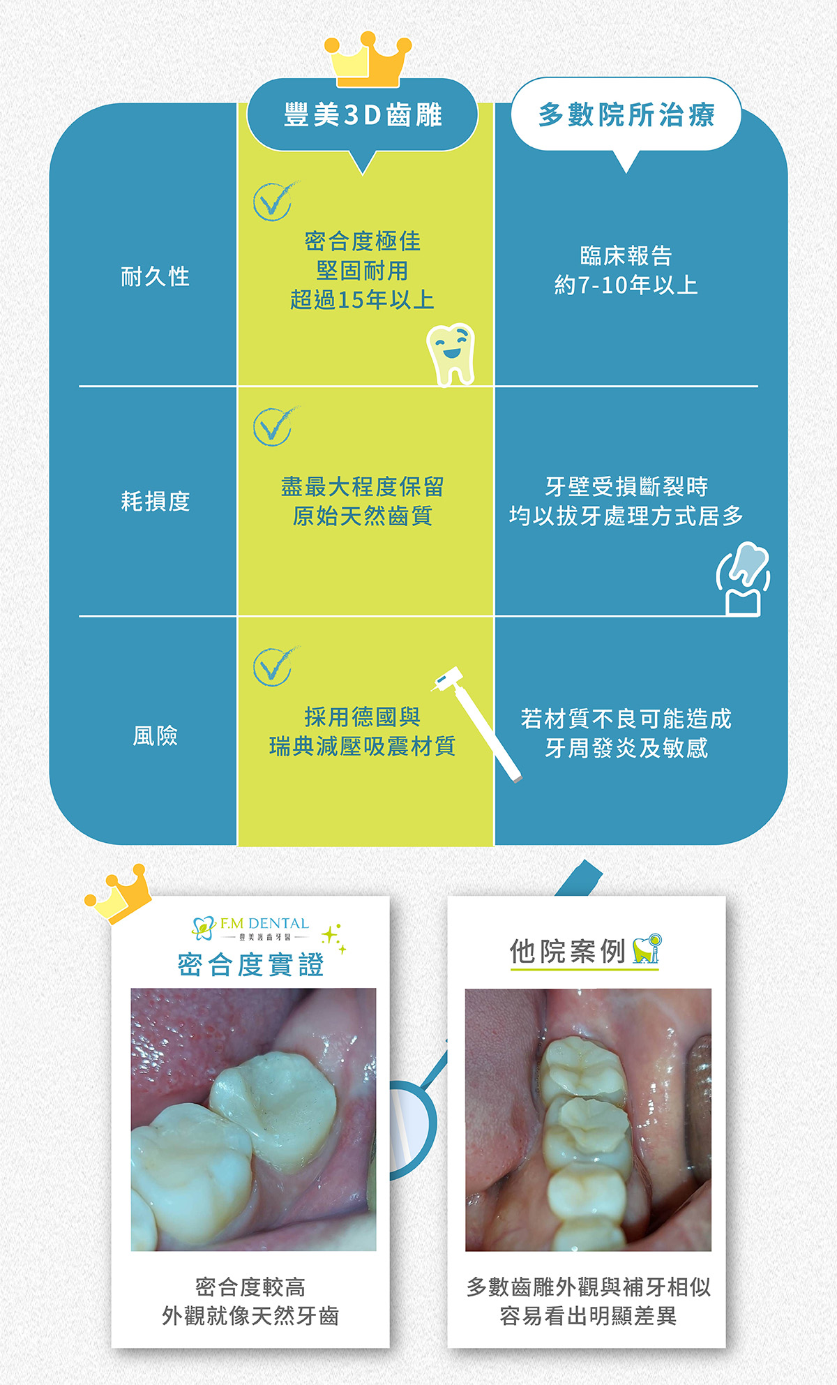 豐美牙醫診所3D齒雕與一般院所齒雕比較。